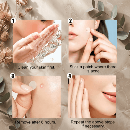 Translucent Hydrocolloid Acne Patches
